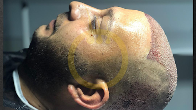 One Hair Clinic Transplantation - Plastic Esthetic klinik görünümü