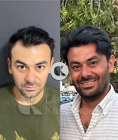 Davut Karabacak Saç ekim merkezi / Saç PRP'si klinik görünümü