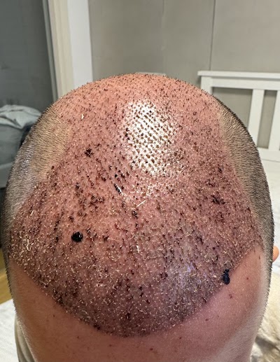 Double Hair Center | Saç Ekim Merkezi klinik görünümü