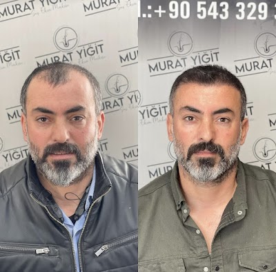 Gaziantep Saç Ekimi - Murat Yiğit klinik görünümü