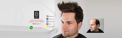 Hairex - Protez Saç klinik görünümü