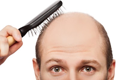 Trabzon Naturel Saç Ekim klinik görünümü
