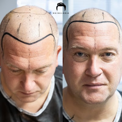 Hairglobal klinik görünümü