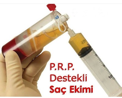 Saç Ekimi(Naturel) klinik görünümü