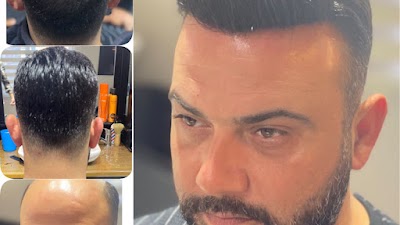 Mersin Protez Saç - Alix Hair klinik görünümü