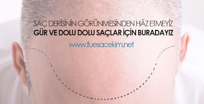 Gaziantep Saç Ekim - Fue Saç Ekim Merkezi fueestetik klinik görünümü