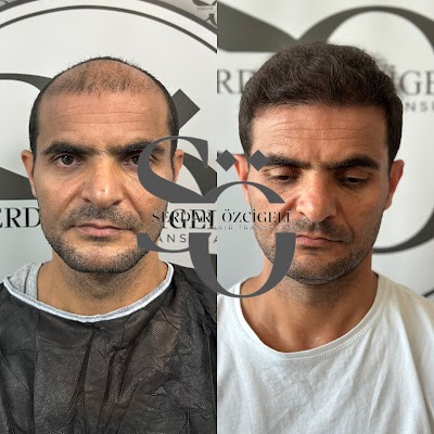 Serdar Özcigeli Saç Ekimi Danışmanlık klinik görünümü