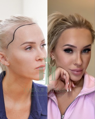 Hair of Istanbul | Hair Transplant klinik görünümü