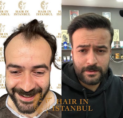 Hair in istanbul | Hair Transplant in Turkey klinik görünümü