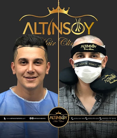 Trabzon Saç Ekim Merkezi Saç PRP`si | Altınsoy Hair Clinic klinik görünümü