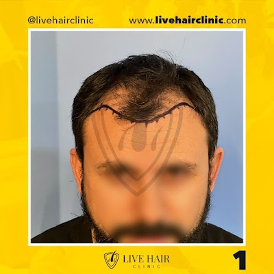 Live Hair Clinic İstanbul Saç Ekim Merkezi klinik görünümü
