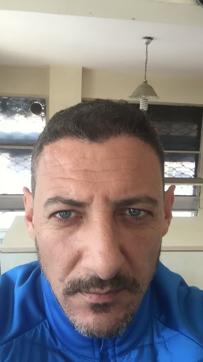FTM Saç Ekim Merkezi - Konya Saç Ekimi klinik görünümü
