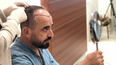 Techestetik Saç Ekim Merkezi - Hair Transplant Istanbul klinik görünümü