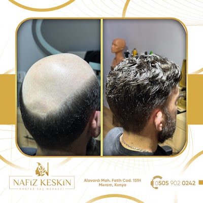 Nafiz Keskin Protez Saç Kliniği klinik görünümü