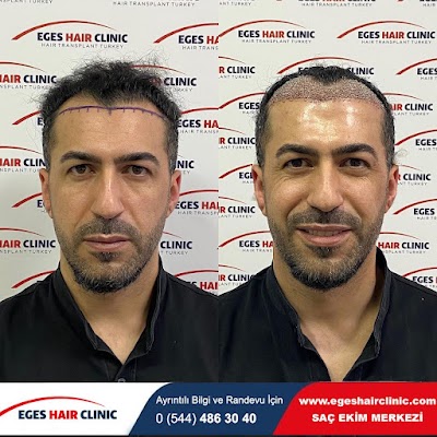 İzmir Saç Ekim Merkezi | Eges Hair Clinic klinik görünümü