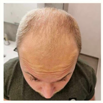 VEYSİ KAPLAN SAÇ EKİMİ & ESTETİK klinik görünümü