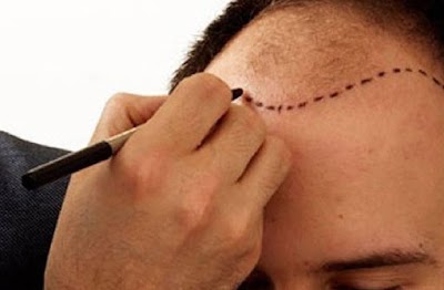Rize Saç Ekim Merkezi - Hair Clinic klinik görünümü