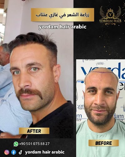 yordam hair saç ekim klinik görünümü