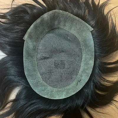 SS Hair Design - Erkek Kuaförü - (Berber ) Protez saç merkezi klinik görünümü