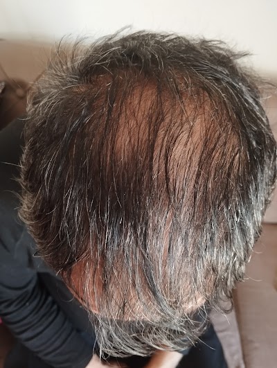 Değişim Saç Ekim Merkezi Ağrı klinik görünümü