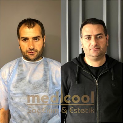Adana Saç Ekimi Medicool klinik görünümü