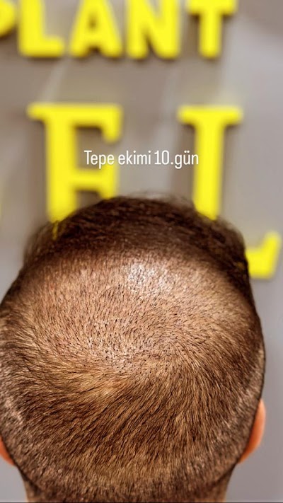 Batman Saç Ekim merkezi Veysel Yılmaz klinik görünümü