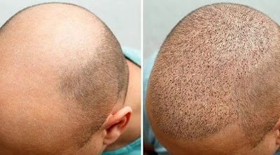 Trabzon Saç Ekim Merkezi - Hair Clinic klinik görünümü