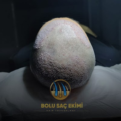 Bolu Saç Ekimi Merkezi klinik görünümü