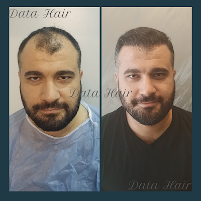 Data Hair Clinic & Eyyüp Tütüncü Saç Ekim Merkezi klinik görünümü