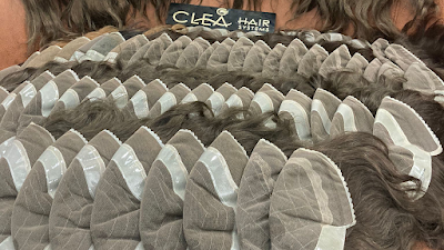 Ankara Clea Hair Protez Saç klinik görünümü