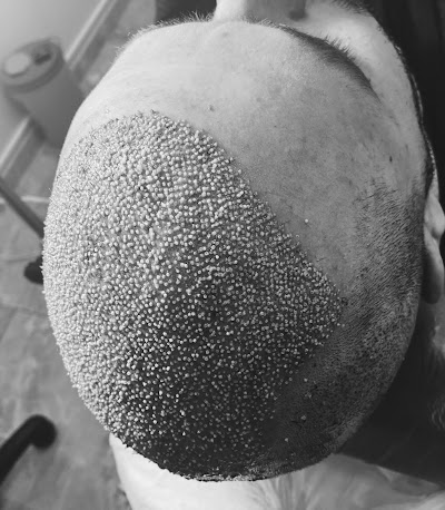 Bayraklı Saç Ekim Merkezi - İzmir Eges Hair Transplant klinik görünümü