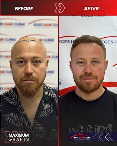 Balıkesir Saç Ekim Merkezi klinik görünümü