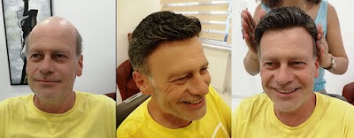 PROTEZ SAÇ HAIR CENTER diyarbakır klinik görünümü
