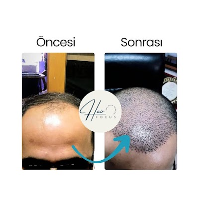Hair Focus | Kayseri Saç Ekim Merkezi klinik görünümü